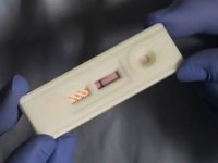 Tüm gebelere HIV taraması