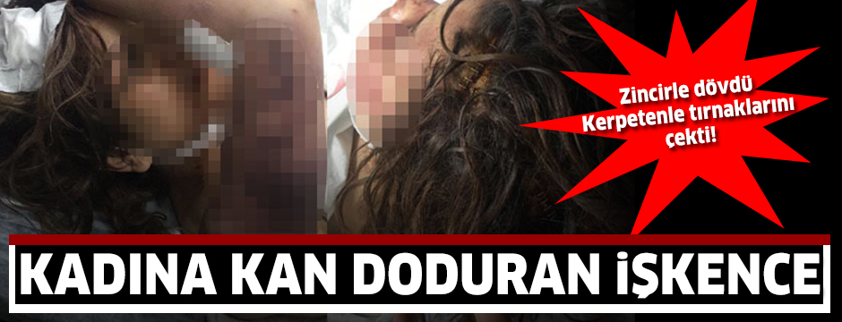 Dini nikahlı eşini zincirle dövüp, tırnaklarını çekerek işkence yaptı