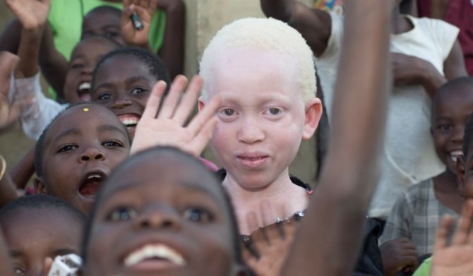 albino-siyahi.jpg