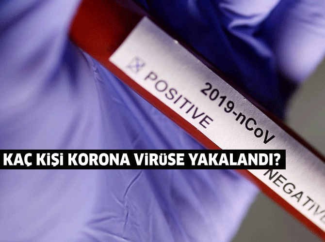 korona-manset-001.gif