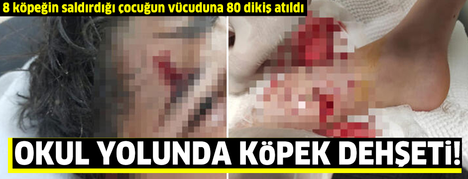 okul-yolu-kopek-dehseti-manset.jpg